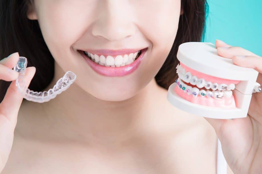 Clear Aligners vs Metal Braces- Which Are Best for You