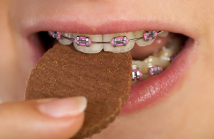 Treats That Are Safe To Eat With Braces