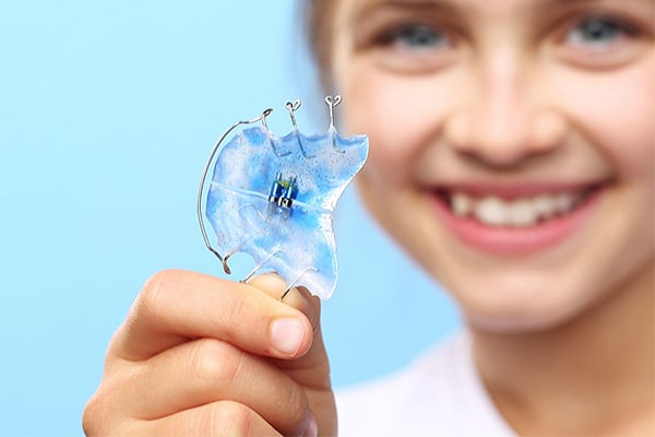 Orthodontic Appliances Image