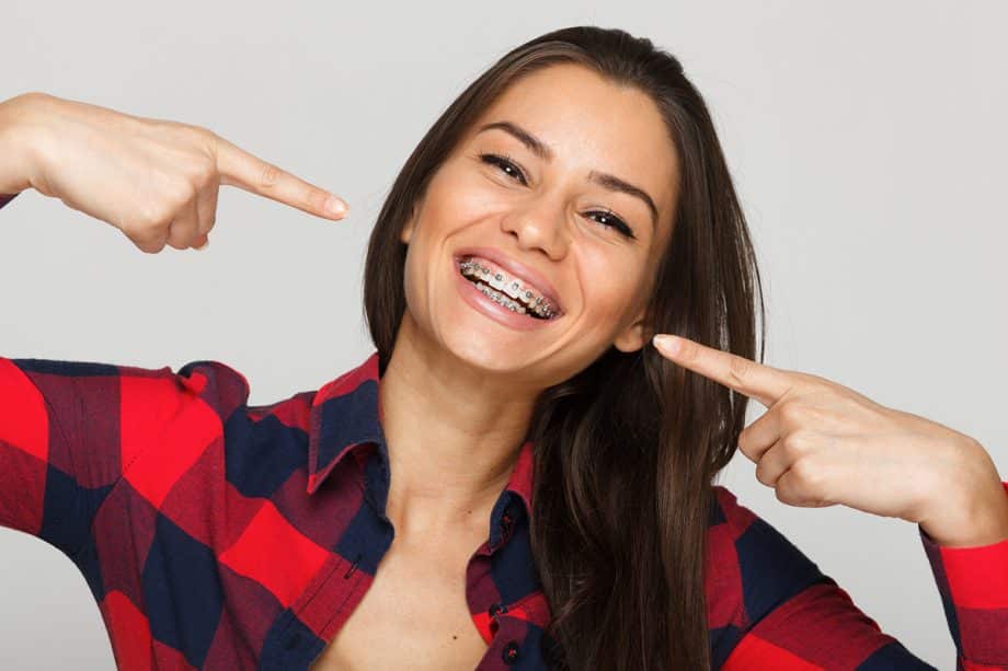 Can You Whiten Teeth with Braces On?