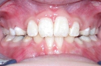 After Photo