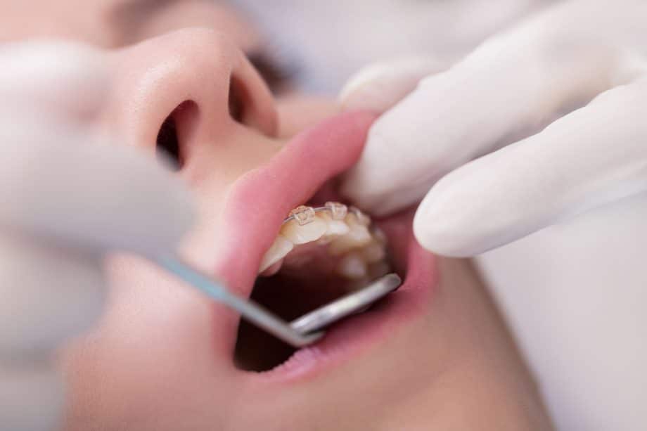 How Do I Know if I’m Picking The Right Orthodontist?