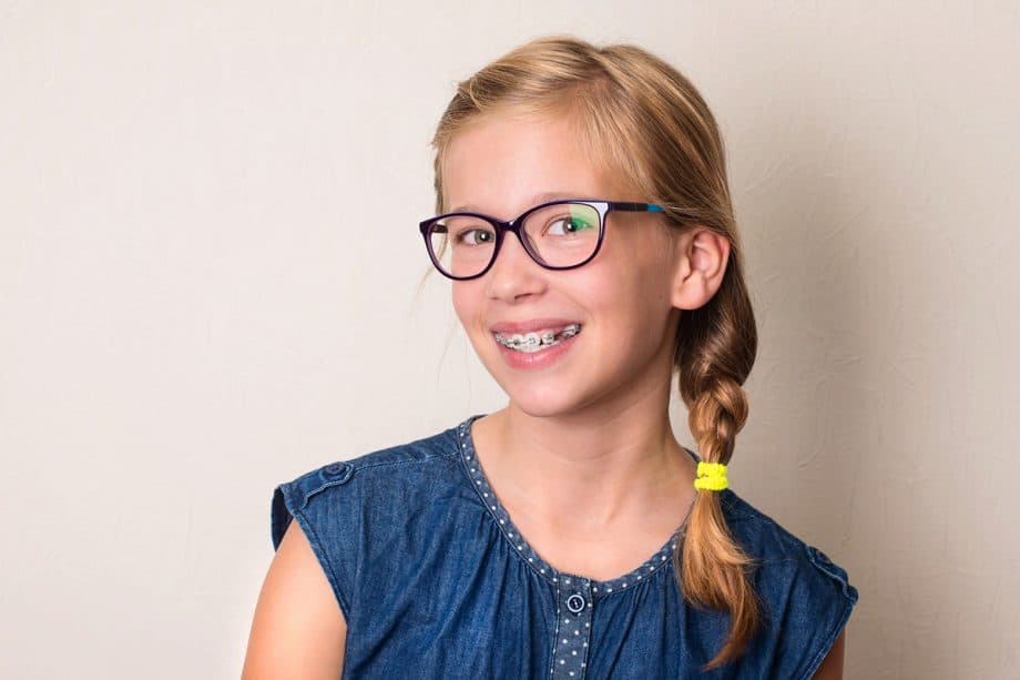 How Long Do Braces Take?