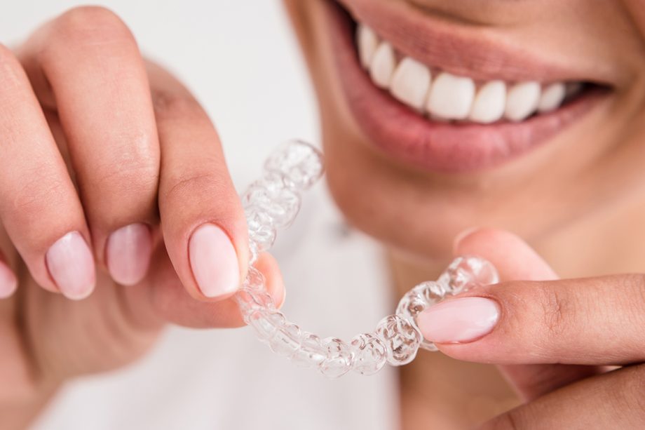 How Long Does Invisalign Take to Straighten Teeth?