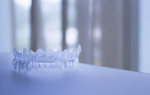 Invisalign Benefits