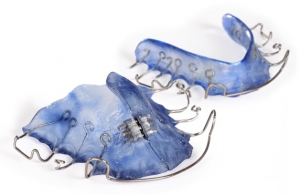 The Importance Of Wearing Your Retainer